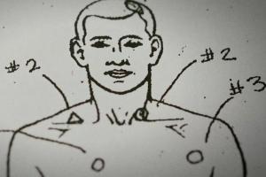 diagram of male body with markings of bullet entrance wounds